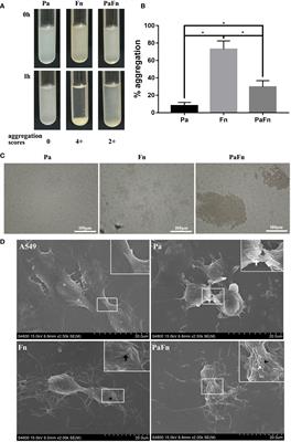 Oral Pathogen Fusobacterium nucleatum Coaggregates With Pseudomonas aeruginosa to Modulate the Inflammatory Cytotoxicity of Pulmonary Epithelial Cells